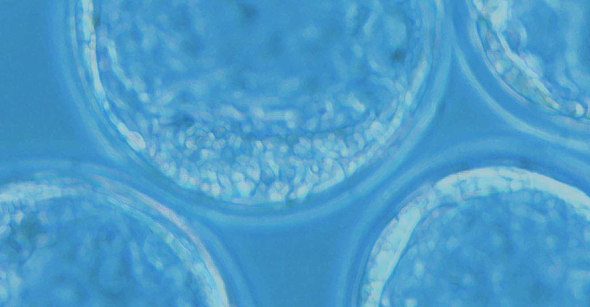 Zoom in murine embryonic stem (ES) cells by PolyGene