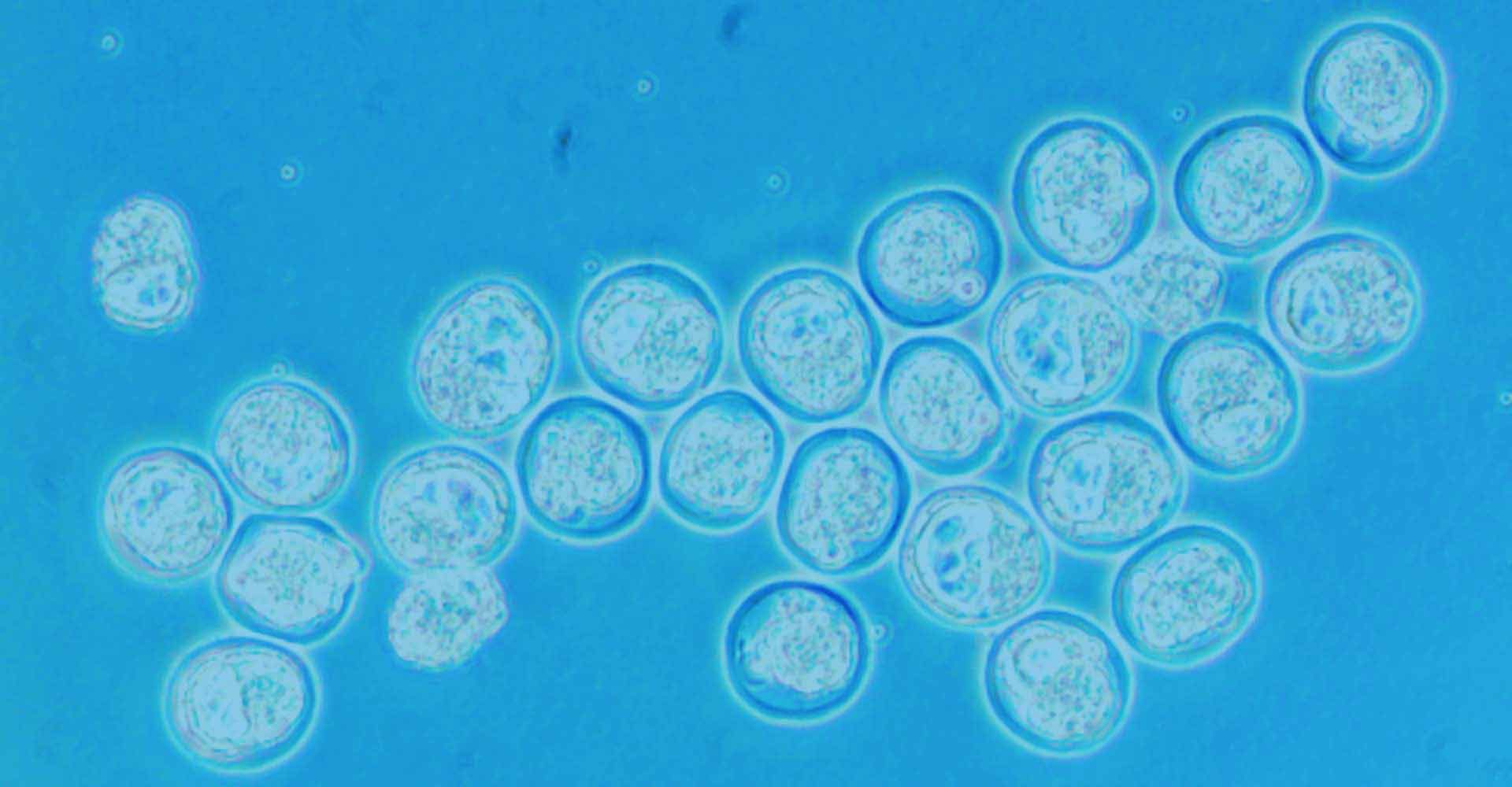 Blastocysts ready for Injection by PolyGene
